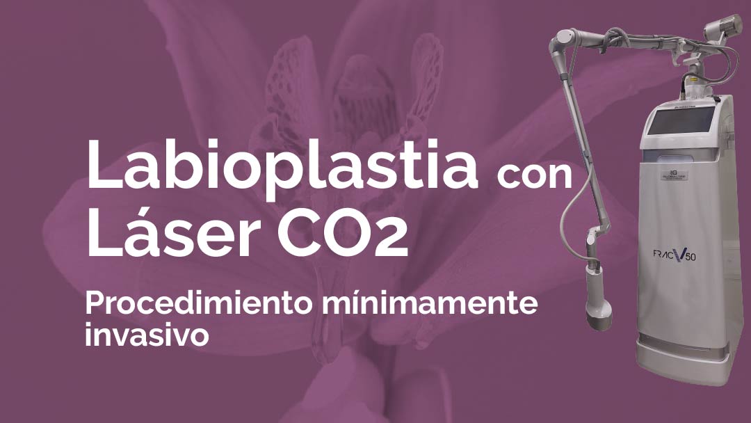 ¿Incomodidad al vestir o hacer ejercicio?  Tu mejor aliada puede ser la labioplastia láser CO2