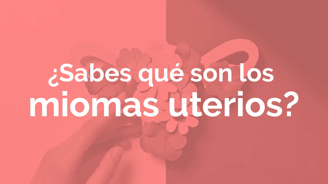 Miomas uterinos
