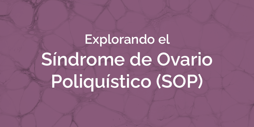 síndrome de ovario poliquistico soy violeta blog